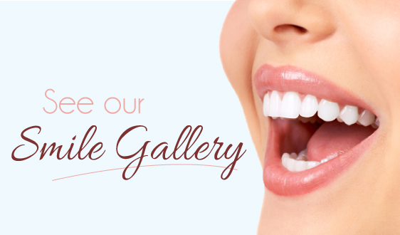 angelina anisimova dds smile gallery manchester